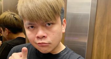 半夜送急診!蔡阿嘎染髮發紅過敏 曝身體恐怖病況:沒辦法睡覺