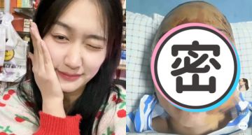 20歲網美上公廁遇襲!瘋子拿磚狂砸頭「挖眼啃鼻」 她毀容崩潰:一輩子沒希望