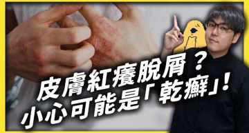 乾癬不會傳染!皮膚科醫師揭「很難根治」:成因是免疫系統失調