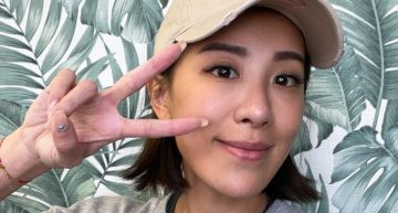 小禎突曬「獨眼照」!紗布蓋滿半張臉 霸氣發文:照樣上工
