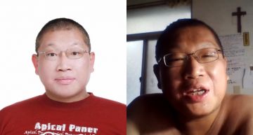 不因殘疾自暴自棄!「光頭哥哥」坦然談憂鬱、躁鬱 暖心叮嚀:愛惜生命,不要敗給負面情緒