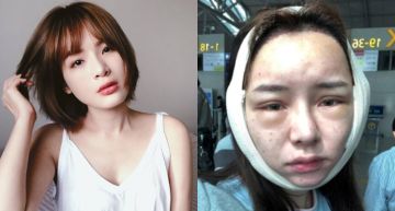 坦承「整形」人氣反飆升!大數據分析15位「修修臉女星」討論熱度超出你想像!