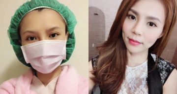 最久3周才嗯嗯!女星「張懷媗」便祕37年 「切除150cm大腸」疼痛度爆表