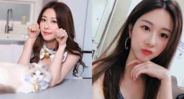 正能量爆發!女星「張景嵐」不避諱秀「手臂疤痕」 坦言:沒有人是完美的