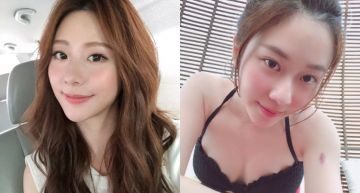 「張景嵐」辣曬蠻腰大長腿!膝蓋驚見「詭異人臉」 她嚇壞:完全不敢對視…