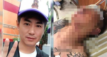 直播中遭擄走網嚇壞協尋!失聯6小被發現「全身血、手腳斷」重傷送醫