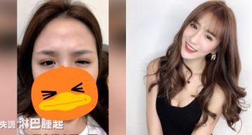 「玩很大女神」竹竹內分泌失調!淋巴、腮腺「腫到臉變形」 大根看傻:這誰啊!?