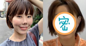 跌倒假鼻撞成「朝天鼻」!「金老佛爺」等4年終於進廠維修…術後照曝光瘋狂落淚