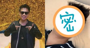「黑男」近況曝光嚇壞人!眼睛「兩團烏青」空洞神情如屍變…全身插針治療:我會加油