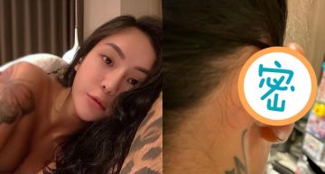 打耳洞腫到「肉包耳環」!梁云菲痛到發出「被宰雞叫」 醫驚:比蜂窩性嚴重!