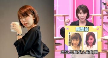 「金老佛爺」假鼻摔成豬鼻!談「進廠經驗」秒淚崩…同步公開手術費用:對不起家人
