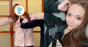 剷肉35公斤!小甜甜秀「火柴人」身材卻驚見「脖子恐怖摺痕」 網驚:肉鬆到像戴假面具!