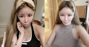 整形60次!超兇網紅「術後0修圖照」曝光 網嚇瘋:看了會做惡夢