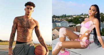 NBA知名球星爆熱戀「白斑症女模」!牽手照曝光:交往一星期了