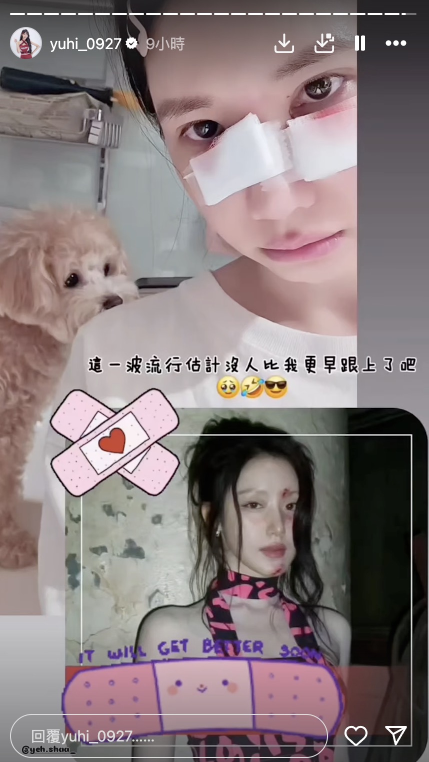 啦啦隊樂天女孩超人氣成員筠熹意外遭愛犬咬傷臉部!破相消息令粉絲心疼