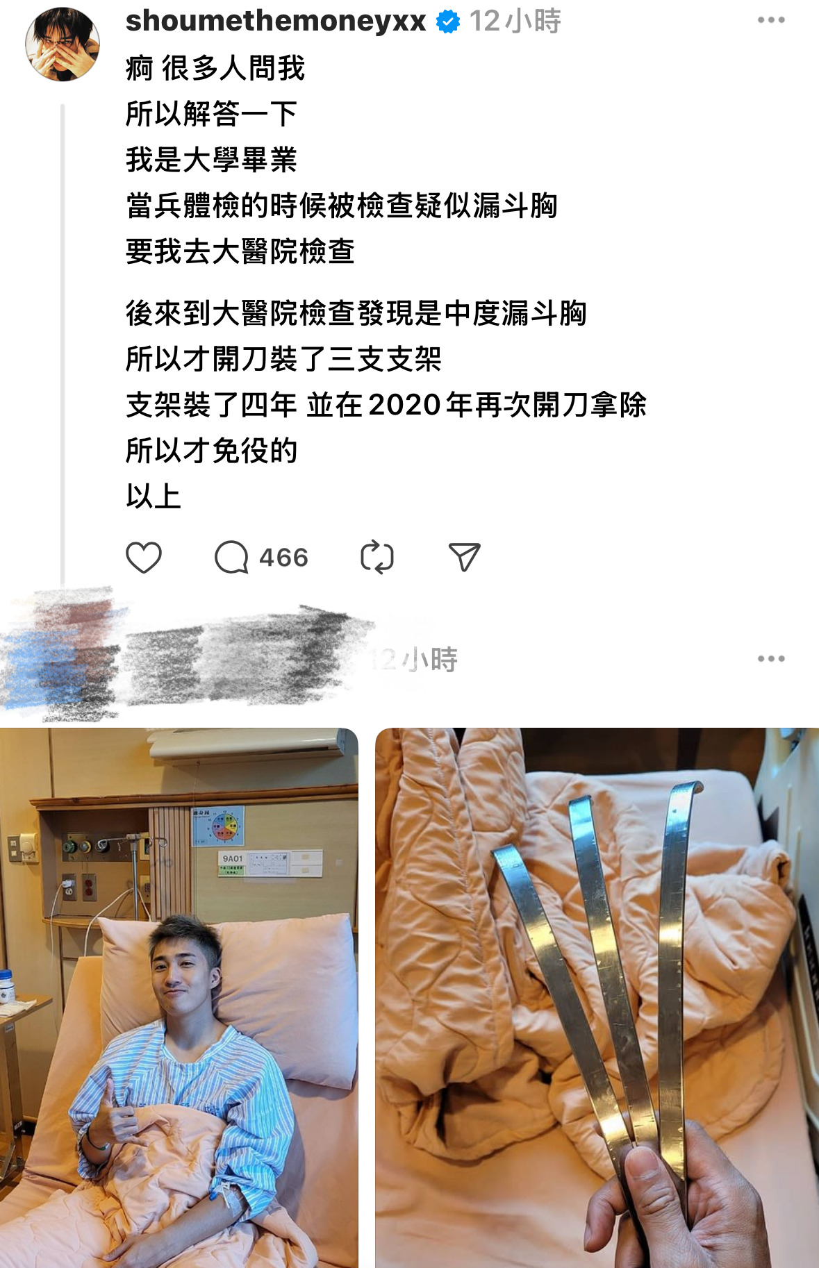 陳零九捲逃兵風波!五堅情遭輿論牽連 婁峻碩自曝病史:體內裝入三支支架