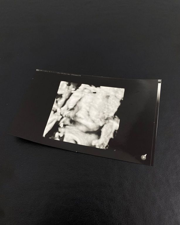 快訊／GD升格當舅舅！「超音波照曝光」名字都取好了