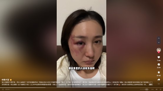 百萬網紅揭露老公家暴惡行!「半年遭爆打4次」險喪命 崩潰還原恐怖遭遇