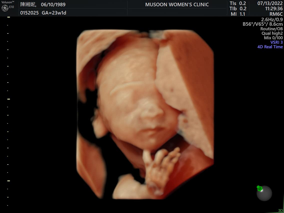 謝和弦曝光「胎兒性別」！莉婭PO寶寶正臉照曝乳名嗨喊：一起管爸爸