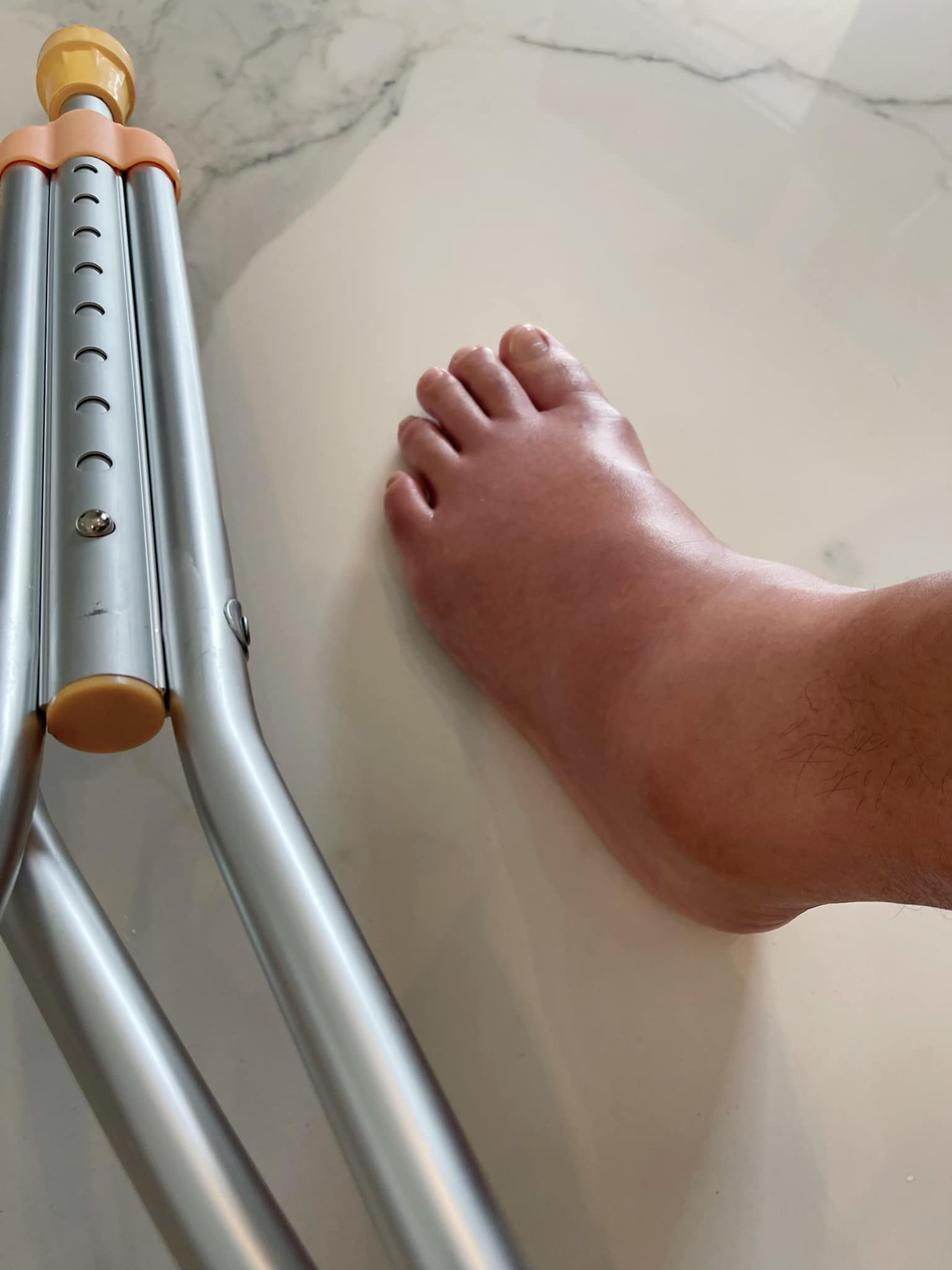 李銘順舊傷復發「不能步行」！遺憾缺席金鐘57　腳腫成兩倍大嚴重傷勢曝光