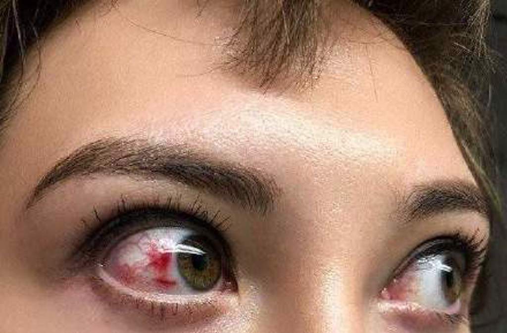混血女星遭子彈碎片打中「眼白秒全紅」!緊急送醫近況曝光