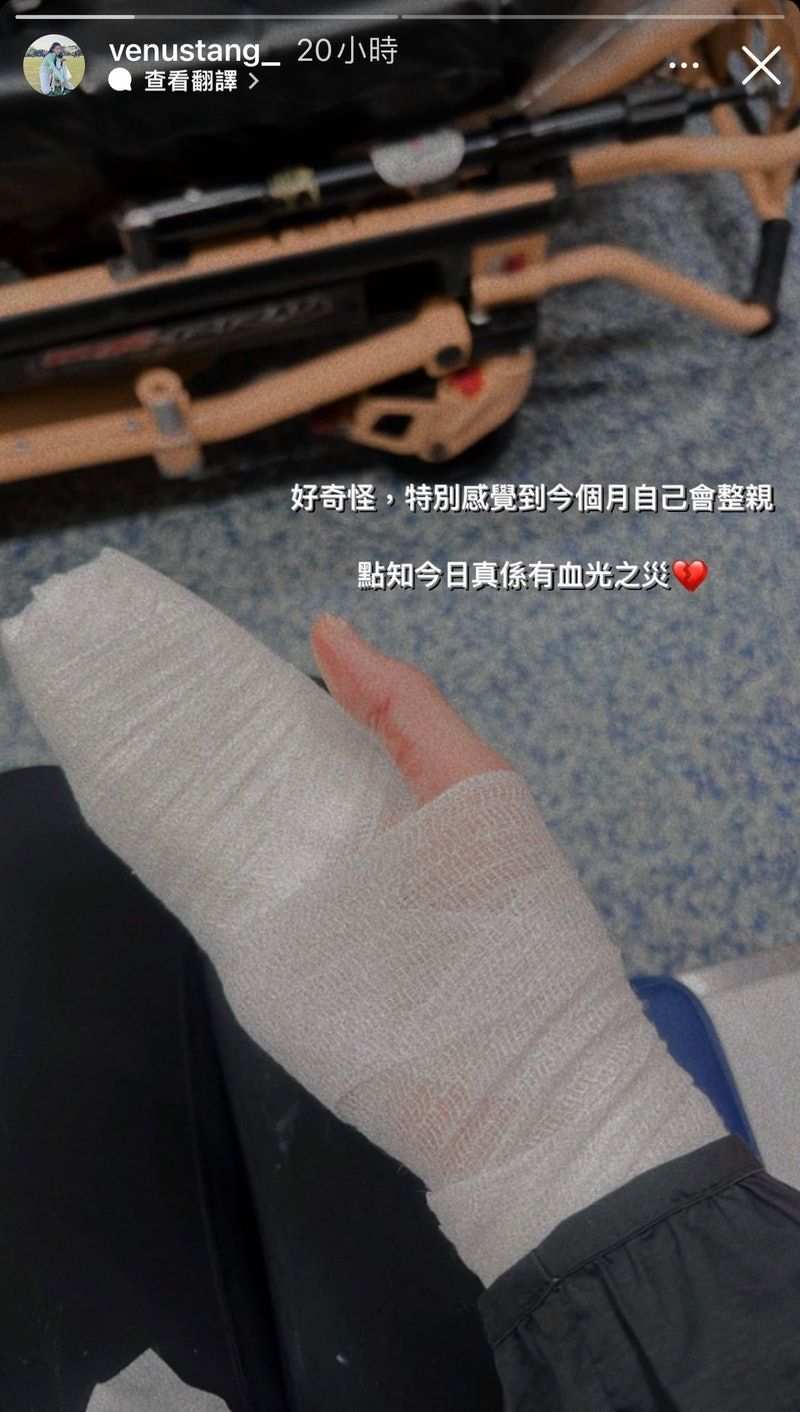 遛狗慘遭「無牽繩洛威拿」狠咬!現場留大片血跡 女星崩潰近況曝光