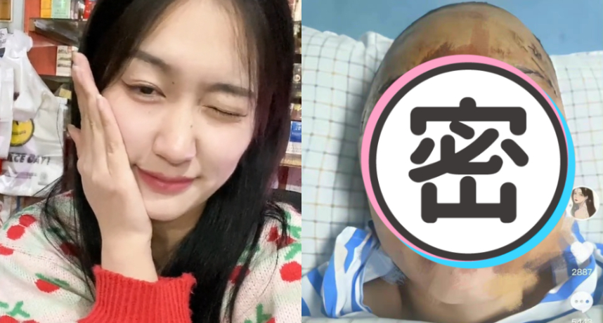 20歲網美上公廁遇襲！瘋子拿磚狂砸頭「挖眼啃鼻」　她毀容崩潰：一輩子沒希望