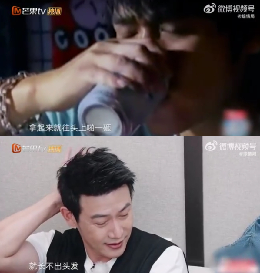 影帝曝低潮期患抑鬱症!痛苦到「拿煙灰缸自砸頭」 愛妻心疼:疤已經長不出頭髮