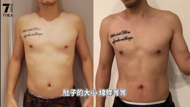躺著變彭于晏?網紅砸20萬「人造6塊肌」 網驚:醫學超發達