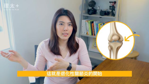 關節常出現啪啪聲!理科太太曝「身體出現警訊」:關節炎的開始