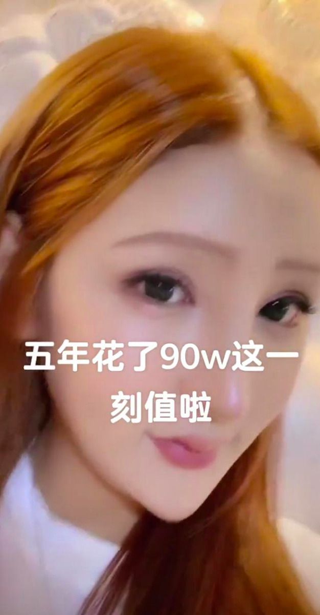  花300萬整成魚精！網紅爆「手術失敗」：整張臉凹成好多洞