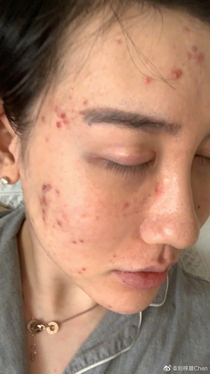 嘴硬「國外不用戴口罩」!蛇精男「確診後現身」曝現階段近況