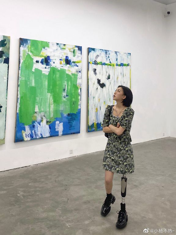 從小失去右腿！正妹「穿20年義肢」超有型穿搭迷翻網