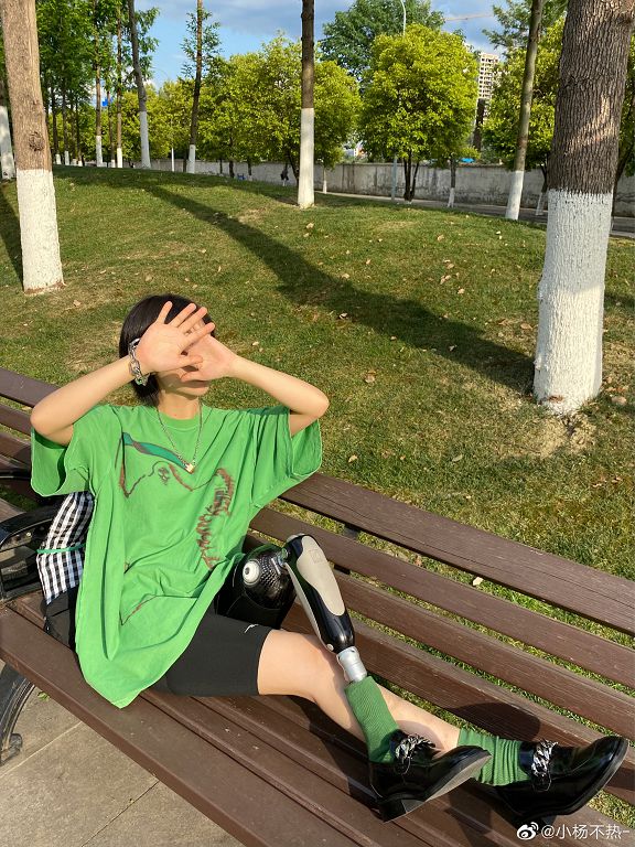 從小失去右腿！正妹「穿20年義肢」超有型穿搭迷翻網