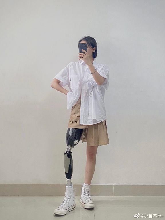 從小失去右腿！正妹「穿20年義肢」超有型穿搭迷翻網
