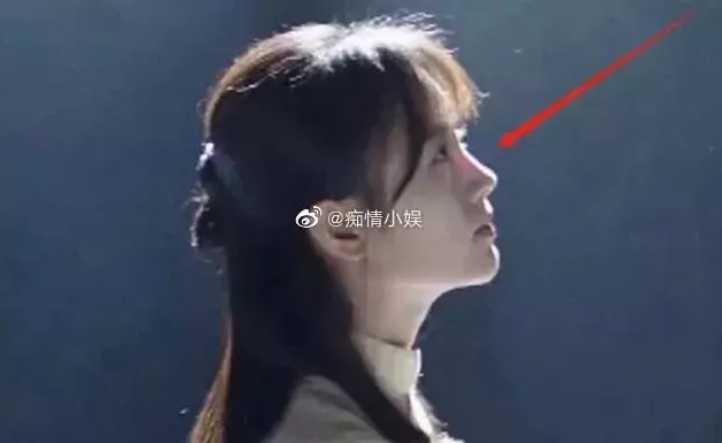 該維修了？鞠婧禕鼻子「被抓包透光」　網：水泥柱直達天靈蓋