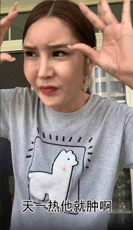 臉上打進400多支玻尿酸!網紅「整形失敗」崩潰:我變畸形了