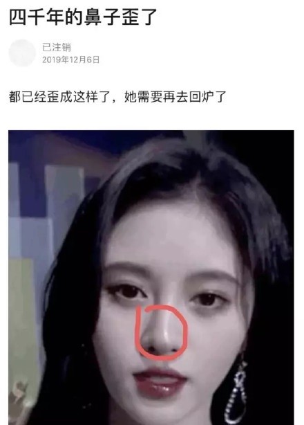 該維修了?鞠婧禕鼻子「被抓包透光」 網:水泥柱直達天靈蓋