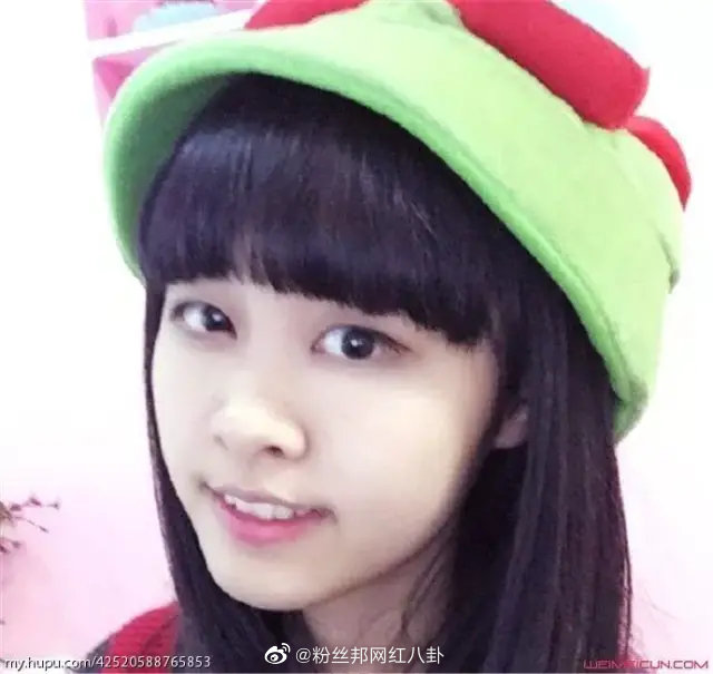 清純少女變僵硬娃娃！實況主「整形失敗」被罵爆　直播失控爆哭