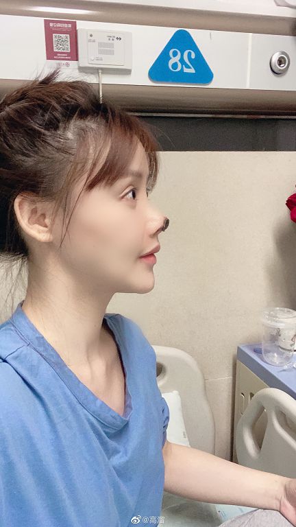 女星整形失敗「鼻頭全壞死」!驚悚照曝光 網全嚇歪!
