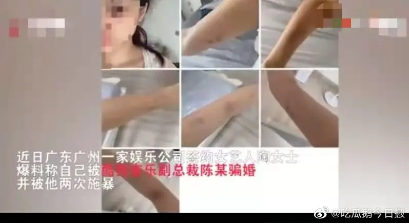 20歲網紅「慘被騙婚生子、家暴」！爆渣男身分：是知名音樂平台副總裁