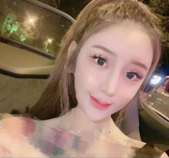 花300萬整成魚精!網紅爆「手術失敗」:整張臉凹成好多洞