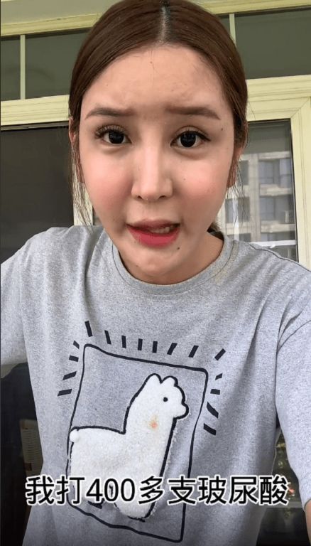 臉上打進400多支玻尿酸!網紅「整形失敗」崩潰:我變畸形了