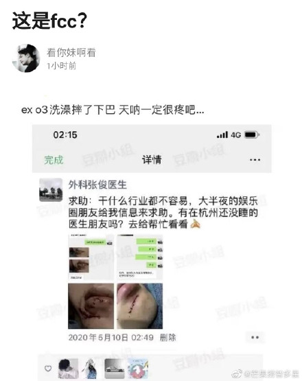 小鬼猝逝!藝人「浴室意外」連環爆:阿嬌縫百針、他摔裂肋骨