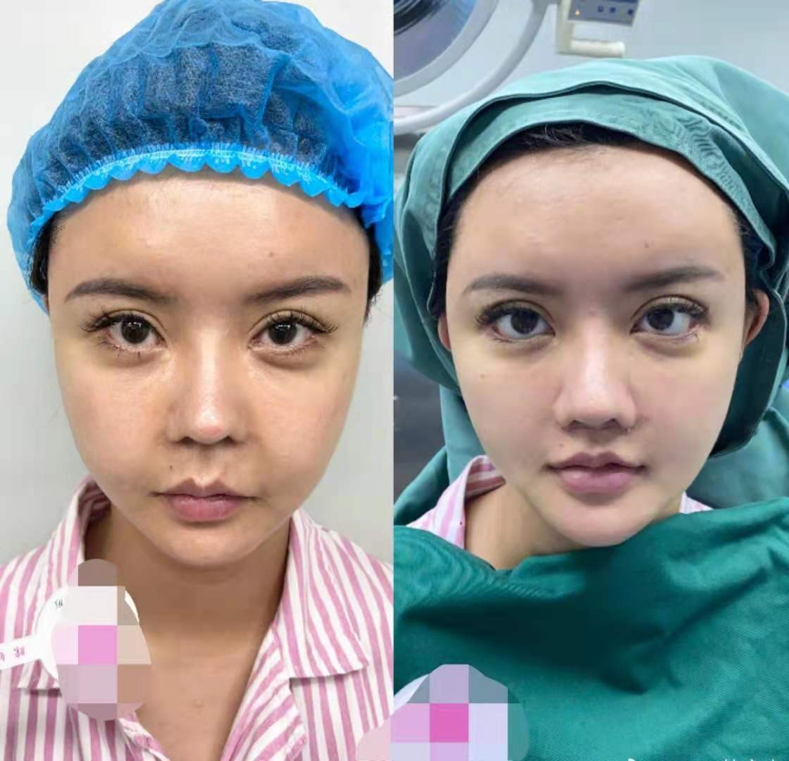 全身都整形！韓安冉「術後照曝光」　身材驚人對比看傻網