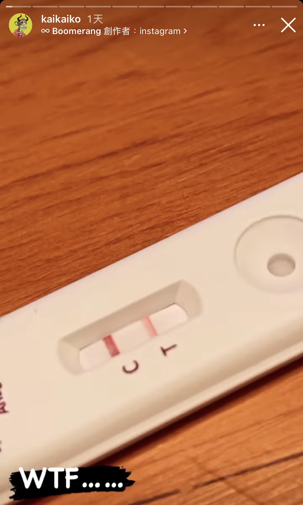 三天內病況惡化!柯震東「陰轉陽近況」全洩 無奈嘆:真是千變萬化