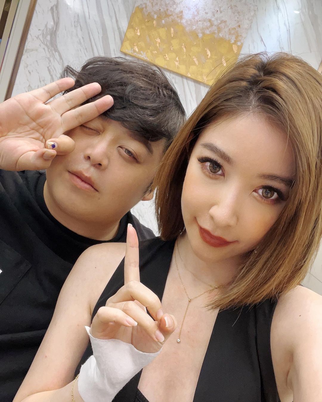 微血管爆裂!許維恩「大片瘀青曝光」:健身時舉太重