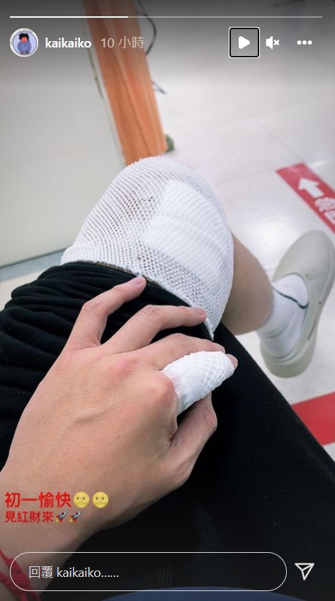 柯震東揭受傷原因!勸架反被咬「腿破3個洞」驚呼:差點絕子絕孫