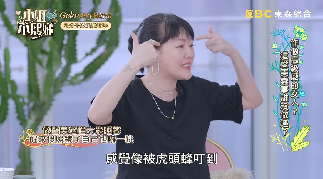 小S醫美睡著!醒來嚇壞「太陽穴腫超大」 老公見狀氣炸