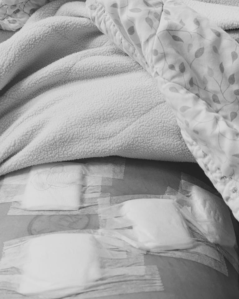 《天之驕女》潘逸安驚傳住院開刀!肚子開4洞「切除腫瘤」曝現況:有點幸運
